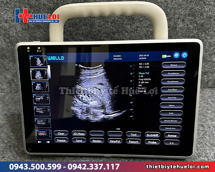Máy siêu âm xách tay 2 đầu dò